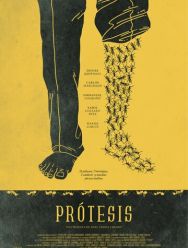 Протез